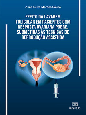 cover image of Efeito da lavagem folicular em pacientes com resposta ovariana pobre, submetidas às técnicas de reprodução assistida